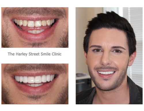 Andy