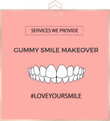 Gummy Smile Makeover - Harley St Smile