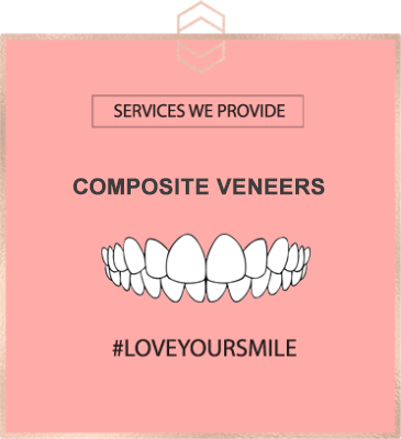 Composite Veneers